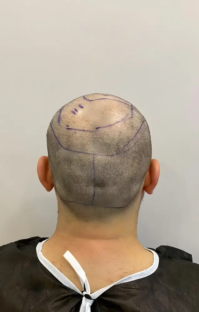 d55308c5e0444444444